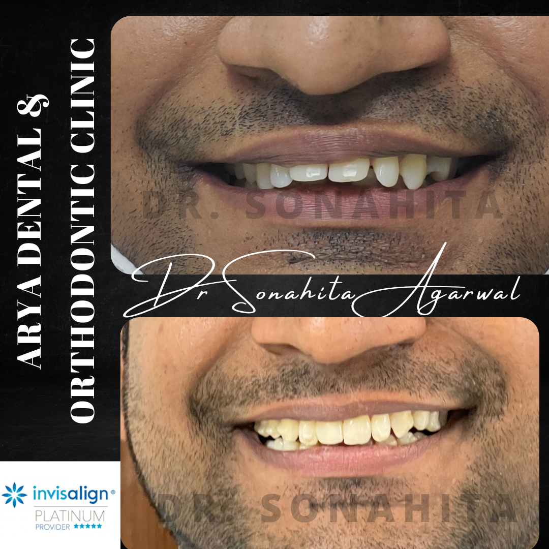 Patient smile transformation 2