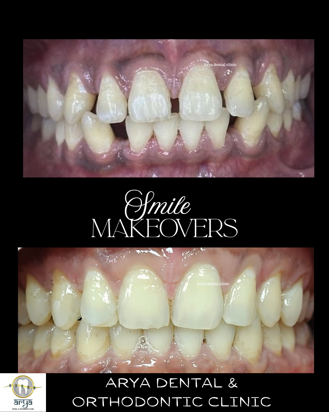 Patient smile transformation 3